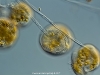 vorticella_1